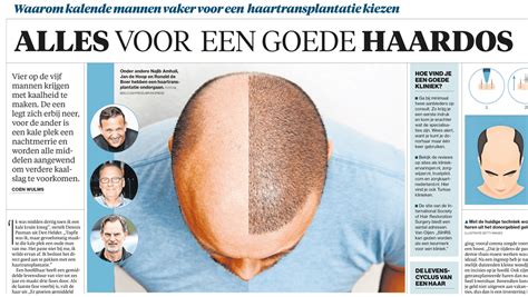 Haartransplantatie Voor Mannen: Een Uitgebreide Gids